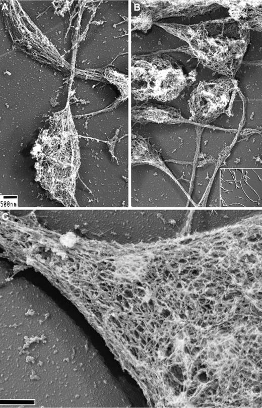 Figure 1. Structure of the proplatelet membrane skeleton. (A-B) Representative electron micrographs of the detergent-insoluble proplatelet cytoskeleton. Proplatelets were permeabilized with 0.75% Triton X-100, 0.1% glutaraldehyde, and 5μM phallacidin in PHEM buffer. Examination of the proplatelet membrane skeleton through electron microscopy reveals an intact membrane skeleton that laminates the underside and extends along the entire length of proplatelets. Inset: DIC image of murine proplatelets. Scale bar indicates 500 nm. (C) High-magnification, 3D electron micrograph of the proplatelet membrane skeleton showing the lattice-like network of elongated filamentous strands, which is similar in nature to the spectrin-based meshwork in erythrocytes and platelets. The membrane skeleton continuously laminates the underside of the proplatelet. A cytoplasmic bridge is shown (left) connecting to a swelling (right). Scale bar indicates 200 nm.