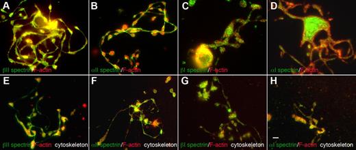 Figure 3. Localization of spectrin isoforms within proplatelets. Micrographs of immunofluorescence studies performed with spectrin antibodies reveal differential localizations for spectrin isoforms within proplatelets. The top panels (A-D) show proplatelet-producing MKs that were fixed before staining. The bottom panels (E-H) denoted “cytoskeleton,” show proplatelets permeabilized in 0.1% Triton-X 100 before fixation to remove soluble and membrane-associated structures. All micrographs are merged images of cells that were double-labeled with spectrin isoform antibodies (green) and F-actin staining by phalloidin (red). The isotype probed and the fluorophore of the secondary antibody are indicated in each panel. (A-D) α1 and β1 spectrins decorate punctate spots distributed throughout the proplatelets. α2 and β2 spectrins localized strongly along proplatelet shafts, proplatelet tips, and swellings. Both α2 and β2 spectrin isoforms colocalized with F-actin. All 4 spectrin isoforms tested were retained in the cytoskeleton of permeabilized cells (E-H) and displayed a similar localization pattern to nonextracted cells. Spectrin 1 isoforms stained in a punctate pattern throughout the proplatelet skeleton, whereas spectrin 2 isoforms displayed a more cytoskeletal localization in permeabilized cells. Scale bar indicates 5 μm.