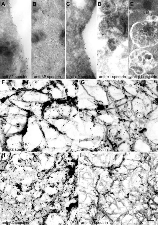 Figure 4. Localization of spectrin isoforms at high resolution. (A-E) Localization of erythroid and nonerythroid spectrin isoforms in ultrathin sections of mouse MKs. Immunogold labeling of sections was performed with anti–β2 spectrin (A,B), anti–α2 spectrin (C), anti–α1 spectrin (D), and anti–β1 spectrin (E) antibodies. Gold particles (10-nm) recognizing anti–β2 spectrin (A-B) are evident on the plasma membrane and invaginated membranes of MKs. Gold particles recognizing anti–α2 spectrin (C) are also found on MK membranes. Gold particles recognizing anti–α1 spectrin (D) and anti–β1 spectrin (E) stained multivesicular bodies of MKs. Scale bar represents 200 nm. (F-I) Localization of spectrin isoforms in the detergent-insoluble cytoskeletons of proplatelets and platelets. Immunoelectron microscopic studies were used to localize individual spectrin isoforms in the membrane skeletons of proplatelets (F-G) and platelets (H-I). Preparations were incubated with affinity-purified anti-β2 (F,H) and anti–β1 spectrin (G,I) antibodies, followed by 10-nm gold particles coated with secondary antibodies. Scale bar shown in panel I indicates 100 nm. Proplatelets labeled with anti–β2 spectrin (F) and anti–β1 spectrin (G) have similar staining patterns, labeling the strands composing the membrane skeleton. Human platelet cytoskeletons were labeled with anti–β2 spectrin (H) and anti–β1 spectrin (I). β2 spectrin gold labeling was increased, whereas β1 was decreased in the platelet cytoskeleton. The gold particle density per square micrometer of cytoskeleton preparation was 53 ± 10 for anti–β2 spectrin of proplatelets (F), 69 ± 8 for anti–β1 spectrin of proplatelets (G) 232 ± 25 for anti–β2 spectrin of platelets (H), and 4 ± 2 for anti–β1 spectrin of platelets. Data are provided as means ± SE (n = 20). Experiments were carried out in triplicate. Scale bar represents 100 nm.