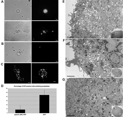 Figure 5. Expression of spα2N1 inhibits proplatelet elaboration by MKs and prevents IMS maturation. (A) The introduction of spα2N1-GFP in MKs through retroviral infection inhibited proplatelet formation. Most MKs expressing spα2N1-GFP failed to make proplatelets (A top panel), although a few developed primitive proplatelets (A bottom panel). Left panels show phase contrast images and right panels show fluorescence images. (B) Control uninfected MKs, identified by lack of green fluorescence, form normal proplatelets. (C) Fluorescence images of proplatelet formation by control MKs expressing GFP alone. Scale bars indicate 7.5 μm. (D) Quantitative analysis of proplatelet formation in spα2N1-GFP–expressing and control, GFP-expressing MKs. spα2N1-GFP–expressing MKs show a dramatic reduction in the percentage of proplatelets formed (8% compared with 44% in control cells). Bars represent the standard deviations. (E-G) Representative electron micrographs of a noninfected MK (E), a MK expressing GFP alone (F), and a MK expressing spα2N1-GFP (G). Control MKs (E-F) show an extensive, open IMS that fills the cell cytoplasm, whereas spα2N1-GFP–expressing MKs (G) do not. Insets show low-magnification views of the corresponding cells. Scale bars indicate 4μm.