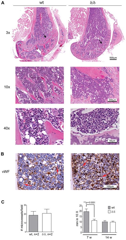 Figure 2. BM morphology and microvessel density of Vegfaδ/δ mice are normal while the endochondral ossification is decreased. (A) Representative histology images of mouse BM sections were captured from 1 WT mouse and 2 Vegfaδ/δ mice in the trabecular area of distal femur samples at original magnification ×3, ×10, and ×40. Histologic specimens were stained with hematoxylin and eosin. Arrows indicate the epiphyseal growth plate. (B) BM sections were immunohistochemically stained with VWF to detect microvessels. Original magnification ×20. Red arrows indicate microvessels. (C) The average number of microvessels was counted in 3 different images per mouse captured from 2 mice per group. Bars represent mean ± SD. The thickness of the epiphyseal growth plate in femur was measured manually in 10× magnifications. Bars represent mean ± SD of 7-11 measurements from representative images, P < .0001, t test. All images were captured using a Zeiss slide scanner containing a Sony DFW-X710 camera and MIRAX software.