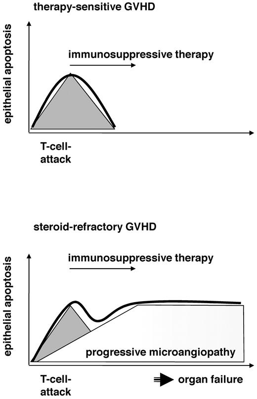 Figure 6. Progressive microangiopathy distinguishes sensitive and refractory clinical courses of GVHD. The working hypothesis is as follows: Sensitive and refractory patients both have a T-cell attack (gray triangle) that responds to standard (sensitive) or salvage (refractory) immunosuppressive therapy. Epithelial apoptosis (thick line) is induced by T cells in sensitive patients and responds to immunosuppressive therapy after clearing the T-cell response (top panel). In contrast to sensitive patients, steroid-refractory patients have a vulnerable endothelial system that reacts to the initiating T-cell attack with progressive endothelial damage. This microangiopathy may cause organ failure and promote epithelial apoptosis, although the initiating T-cell attack was cleared (bottom panel).
