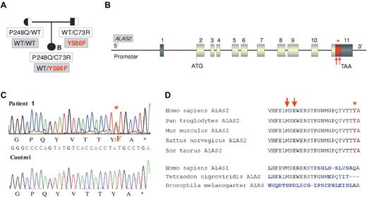 Figure 1. ALAS2 mutation in the family of patient 1. (A) Pedigree of the CEP family with both ALAS2 and UROS mutations. Cosegregation of UROS mutations (white boxes) and ALAS2 mutations (gray boxes) is shown. (B) Representation of ALAS2 gene: Dark boxes represent untranslated regions and gray boxes coding exons. The red part of the last exon corresponds to the domain in which mutations causing XLDPP have been found (red arrows). The red star corresponds to the Y586F substitution found in the CEP proband (patient 1). (C) C-terminal mutation in ALAS2. Sequence analysis of genomic DNA from CEP patient 1 demonstrating c.1757 A > T (Y586F) mutation in the ALAS2 gene. (D) Comparison of the C-terminal sequence of ALAS enzymes from different species. Red arrows indicate the location of XLDPP mutations and the red star indicates the location of the Y586F substitution.