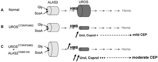 Figure 4. Proposed mechanism for the role of ALAS2 as a modifier gene in CEP. An enhanced kinetic property of the mutated ALAS2 enzyme would cause an increased production of the linear tetrapyrrole HMB, the substrate of UROS. The increased supply of HMB associated with a defective UROS enzyme would lead to the aggravated CEP phenotype. (A) normal individual; (B) CEP patient wild-type for ALAS2; and (C) CEP patient with ALAS2 mutation.