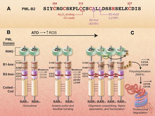 Mutations in As2O3-refractory APL support clinical relevance of experimental model of As2O3 action. (A) B2-Box missense mutation sites from Figure 1D in the article by Goto et al that begins on page 1600. (B-C) Relationship of As2O3 resistance-associated mutations (A216V and L218P) to preclinical model for As2O3-mediated PML-RARα degradation: all steps blocked by experimental site-specific mutation of the critical arsenic-binding/cross-linking dicysteine motif (C212A or C213A; Jeanne et al7); matrix association and sumoylation demonstrated to be blocked by A216V and L218P. Adapted from Jeanne et al7 with copyright permission from Elsevier. Professional illustration by Alice Y. Chen.
