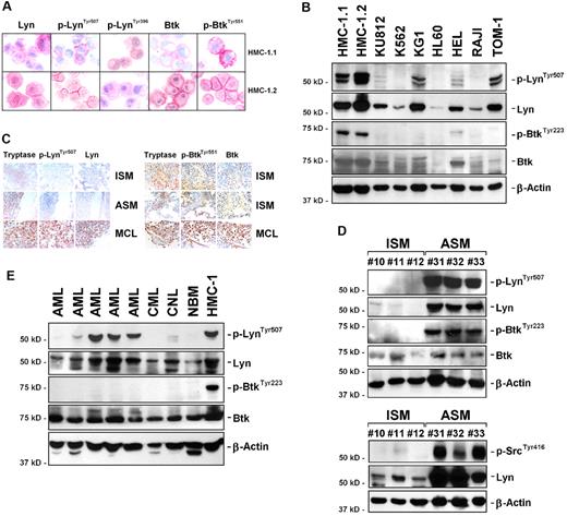 Figure 1. Expression and activation of Lyn and Btk in neoplastic MCs. (A) Immunocytochemical detection of p-LynTyr507, p-LynTyr396, and p-BtkTyr551 as well as total Lyn and total Btk in HMC-1.1 (top panels) cells and HMC-1.2 (bottom panels) cells. (B) Western blot analysis of Btk and Lyn expression in various cell lines using Abs against p-LynTyr507, Lyn, p-BtkTyr223, Btk, and β-actin as indicated. Molecular size markers are also shown. (C) Immunohistochemical detection of tryptase, p-LynTyr507, Lyn, p-BtkTyr551, and Btk in patients with indolent systemic mastocytosis (ISM), aggressive SM (ASM), and mast cell leukemia (MCL). The method of staining is provided in “IHC and ICC.” Figures shown in panels A and C were prepared using an Olympus DP11 camera connected to an Olympus BX50F4 microscope equipped with 100×/1.35 UPlan-Apo objective lens. Images were prepared using Adobe Photoshop CS2 Version 9.0 software (Adobe Systems) and processed with PowerPoint software (Microsoft). (D-E) Detection of p-LynTyr507, p-SrcTyr416, and p-BtkTyr223 in primary neoplastic cells by Western blotting. Neoplastic cells were obtained from patients with ISM (n = 3) and ASM (n = 3; D) as well as from patients with acute myeloid leukemia (AML, n = 5), chronic myeloid leukemia (CML, n = 1), and chronic neutrophilic leukemia (n = 1; E). In addition, normal BM cells (NBM, control) and HMC-1.2 cells (positive control) were examined (E). The β-actin control as well as size markers are also shown.