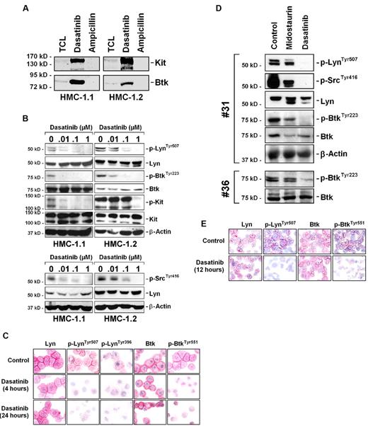 Figure 4. Effects of dasatinib on Lyn and Btk activation in neoplastic MCs. (A) Total cell lysates from HMC-1.1 cells (TCL) and proteins that were bound by immobilized dasatinib were immunoblotted for KIT and Btk. Ampicillin served as negative control. (B) HMC-1.1 cells and HMC-1.2 cells were cultured in control medium or in the presence of dasatinib (0.01-1μM for 4 hours). Thereafter, cells were subjected to Western blot analysis using Abs directed against p-LynTyr507, p-SrcTyr416, Lyn, p-BtkTyr223, Btk, and KIT. The β-actin loading control is also shown. To detect KIT activation, an immunoprecipitation was conducted using an anti-KIT Ab followed by immunoblotting using the anti-phosphotyrosine Ab 4G10. (C) HMC-1.2 cells were incubated in control medium (Co) or in medium containing dasatinib (1μM) for 4 hours or 24 hours at 37°C. Then, cells were spun on cytospin slides and stained with Abs specific for Lyn, p-LynTyr507, p-LynTyr396, Btk, and p-BtkTyr551 by indirect immunocytochemistry. Cells were analyzed using an Olympus AX-1 microscope equipped with 60×/1.35 UPlan-Apo objective lens. Image acquisition was performed using an Olympus DP11 camera and Adobe Photoshop CS2 software Version 9.0 (Adobe Systems). Magnification, ×600. (D) Primary neoplastic mast cells from one patient with aggressive systemic mastocytosis (ASM) and one with mast cell leukemia, MCL (no. 31 and no. 36 in Table 1) were cultured in control medium or in the presence of midostaurin (1μM) or dasatinib (1μM) for 12 hours. Thereafter, cells were subjected to Western blot analysis using Abs against p-LynTyr507, p-SrcTyr416, Lyn, p-BtkTyr223, Btk, and β-actin. (E) Immunocytochemistry performed with primary mast cells (ASM patient 30) exposed to control medium or medium containing dasatinib (1μM) for 12 hours. Abs used and the microscopy technique applied were the same as that described for panel C. Magnification, ×600.
