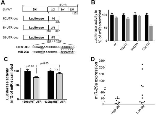 Figure 2. miR-29a binds to 3′UTR of SKI and is associated with low Ski expression in primary AML cells. (A) Scheme of the luciferase constructs. The 3′UTR of Ski was subdivided into 3 approximately 450-bp overlapping fragments (1/2 bp 1-465, 3/4 bp 386-867, 5/6 bp 756-1252) and cloned in the 3′direction of the luciferase gene in the pGL3 control vector. A putative binding site for miR-29a in fragment 5/6 of Ski 3′UTR at bp 1066-1088 is shown. Underlined are complementary parts of miR-29a and SKI 3′UTR. (B) miR-29a targets the 3′UTR of Ski in vitro. The empty luciferase reporter plasmid (ev) or luciferase reporter plasmids carrying the 1/2, 3/4, or 5/6 fragment of the 3′UTR of Ski (1/2-UTR, 3/4-UTR, 5/6-UTR) were cotransfected with scrambled precursor miRNA or miR-29a precursor and with pRL-TK-Luc in HeLa cells. Twenty-four hours after transfection, Firefly luciferase activity was measured. Black bars indicate miR-scrambled; gray bars, miR-29a. Results are representative of 3 individual experiments with 5 replicates. Normalized Renilla luciferase expression in cells transduced with the different SKI-3′UTR plasmids and miRna-scrambled was set at 100%. Values are mean ± SEM. (C) miR-29a targets its predicted binding site in SKI-3′UTR. The luciferase reporter plasmids 130bpWT-UTR or 130bpMUT-UTR contained a 130-bp fragment of 5/6-UTR that flanked the putative binding site in 5/6 at position 1066-1088. The original putative binding sequence CUUAGAAACCCCCUCUGGUGCCU was mutated to CUUAGCAACCTCCUCUCGUACCU. The changed bases are underlined in Figure 2A. HeLa cells were cotransfected with scrambled precursor miRNA (black bars) or miR-29a precursor (gray bars) and with pRL-TK-Luc. Twenty-four hours after transfection, Firefly luciferase activity was measured. Results are representative of 3 individual experiments with 5 replicates. Normalized Renilla luciferase expression in cells transduced with the different 3′UTR-plasmids and miRNA-scrambled was set at 100%. Values are mean ± SEM. (D) miR-29a and Ski expression are inversely associated in human AML samples. Statistical analysis of Ski Western blot data and miR-29a quantitative RT-PCR data showed a significant correlation (P = .020) of high miR-29a expression and low Ski expression in AML patient samples (n = 21).