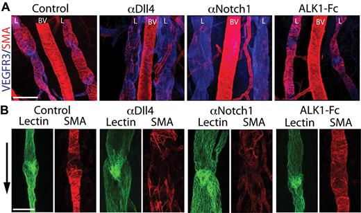 Figure 3. Notch inhibition causes lymphatic collecting vessel dilation and decreased coverage of mural cells. (A) VEGFR3 (blue) and SMA (red) costaining of the upper leg skin in P6 neonate treated with PBS (control), αDll4, αNotch1, and ALK1-Fc (10 mg/kg on P2/5). Images show the lymphatic vessels (L) that drain into the popliteal lymph node on either side of a blood vessel (BV). Scale bar represent 200 μm. The smooth muscle actin (SMA) staining in αNotch sample was imaged at a higher exposure setting due the reduction of mural cell coverage of the lymphatic vessels. (B) FITC-lectin (green) and SMA (red) staining of a lymphatic valve in a P6 neonate treated with PBS (control), αDll4, αNotch1, and ALK1-Fc (10 mg/kg on P2/5). Arrow indicates the direction of lymph flow, and scale bar represents 100 μm.
