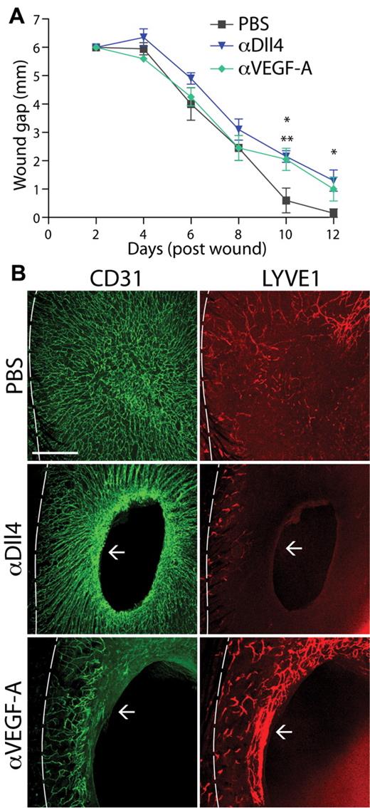 Figure 5. Notch blockade results in defective lymphangiogenesis during wound healing. (A) Wound gap size in control (PBS), αDll4, and αVEGF-A treated mice for 12 days after punch biopsy (n = 5; *αDll4 treatment, P < .05; **αVEGF-A treatment, P < .05). (B) Images of CD31 (green) and LYVE1 (red) costaining of the skin dermis in PBS- (control), αDll4-, or αVEGF-A–treated mice 12 days after a full thickness cutaneous wound. Dotted line represents the approximate skin/wound margin and arrow represents the edge of wound closure. Scale bar represents 500 μm.