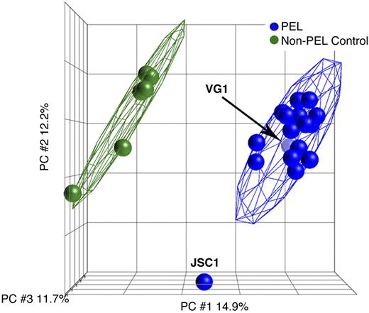 Figure 1. PCA of PEL. PCA shows the presence of 2 distinct clusters formed by endothelial cells in green and all the 17 (excluding JSC1) PEL cells in blue, irrespective of whether they were from culture or xenograft. The x-, y-, and z-axes represent PC1, PC2, and PC3, respectively, accounting for 14.9%, 12.2%, and 11.7% of variability in the data.