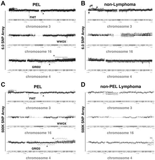 Figure 2. CFS tumor suppressor genes FHIT, WWOX, and GRID dot plot in PEL. Dot plot representation of markers distributed along the chromosome. (A,C) The loss of FHIT, WWOX, and GRID2 from chromosomes 3, 16, and 4, both in the 6.0 and 500K SNP array are shown. The markers (from each of the 13 PELs) are represented by black dots on a log2 scale (amplification denoted by dots above and deletion by dots below the normal 0 line) with the cytoband at the base of plot. The dots identified by ∧ represent alterations that only occurred in 1 of 13 PELs and were thus considered exceptions. (B,D) Data represent 6 nonlymphoma tumor samples and 5 non-PEL lymphoma controls, respectively.