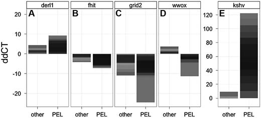 Figure 3. qPCR verification of CFS tumor suppressor gene loss in PEL. (A-E) The qPCR results for DERL1, FHIT, GRID2, WWOX, and KSHV, respectively, are shown. Shown is the stacked relative level (ddCT) for each gene on the vertical axis and the 2 classes of 13 non-PEL (other) and 13 PEL cell lines on the horizontal axis. The contribution of individual cell lines is indicated by the gray level. Because amplifications and deletions result in only a 2-fold change in signal in the case of cellular genes (and ∼ 50-fold for KSHV because there are ∼ 50 copies of the KSHV genome in each PEL cell) the stacked representation integrates both the degree of change as well as the number of cell lines that contribute to the signal in each group (a similar metric was previously validated).39