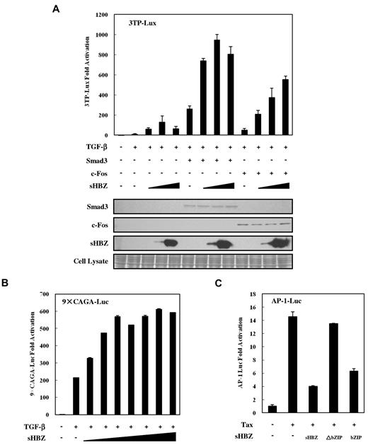 Figure 5. Higher expression of HBZ partially suppressed activation of TGF-β signaling via AP-1. (A) HepG2 cells were cotransfected with 3TP-Lux (0.5 μg), phRL-TK (2 ng), pCDNA3-c-Fos (0, 0.1 μg), FLAG-Smad3 (0, 0.1 μg), and pcDNA3.1-mycHis-sHBZ (0, 20, 200, and 4000 ng). At 24 hours after transfection, the cells were treated with or without TGF-β (10 ng/mL). After 24 hours, the cells were harvested, and luciferase activity was determined. Expression of sHBZ, Smad3, and c-Fos was detected by Western blot (middle panel). CBB staining was shown as the loading control (bottom panel). (B) HepG2 cells were cotransfected with 9 × CAGA-Luc (0.5 μg), phRL-TK (2 ng), and pME18Sneo-sHBZ (0, 2, 5, 10, 20, 50, 100, and 200 ng). Luciferase activity was measured 24 hours after 10 ng/mL TGF-β stimulation. (C) sHBZ inhibited AP-1 signaling via its bZIP domain. Jurkat cells were cotransfected with AP-1-Luc (1 μg), phRL-TK (10 ng), pCG-Tax (1 μg), and pME18Sneo-sHBZ mutants (1 μg). After 48 hours, luciferase activity was measured.