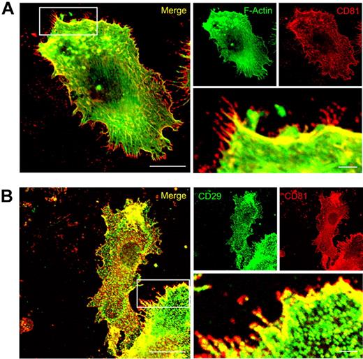 Figure 5. CD81 colocalizes with F-actin and CD29 at the leading edge of migration-relevant membrane protrusions. Immunofluorescence staining of CD81 (red fluorescence, A) and detection of F-Actin localization by the use of Alexa488-phalloidin (green fluorescence, A). Immunofluorescence staining of CD81 (red fluorescence, B) and beta1 integrins (CD29, green fluorescence, B) in LPS-stimulated Mo-DC. The cells were adhered to two-dimensional fibronectin-coated surfaces (5μg/cm2). The fluorescence stainings are confocal images, focused on the basal plasma membrane of the cell. Bars represent 10 μm and 2 μm (magnified detail), respectively.
