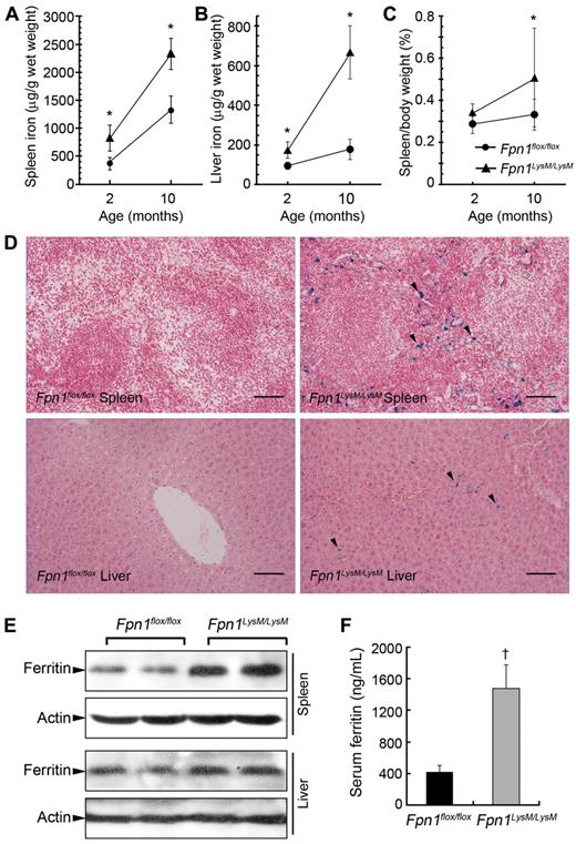 Figure 2. Disruption of Fpn1 in mouse macrophages results in tissue iron accumulation and mild anemia. Spleen (A) and liver (B) nonheme iron concentrations were measured in sex-matched 2-month-old (Fpn1flox/flox, 7 male, 7 female; Fpn1LysM/LysM, 7 male, 7 female) and 10-month-old (Fpn1flox/flox, 3 male, 3 female; Fpn1LysM/LysM, 3 male, 3 female) Fpn1flox/flox and Fpn1LysM/LysM mice. (C) Spleen weight/body weight ratio in 2-month-old (Fpn1flox/flox, 6 male, 6 female; Fpn1LysM/LysM, 5 male, 5 female) and 10-month-old (Fpn1flox/flox, 3 male, 3 female; Fpn1LysM/LysM, 3 male, 3 female) mice. (D) Perls' Prussian blue staining in paraffin sections of spleen and liver from Fpn1flox/flox and Fpn1LysM/LysM mice shows iron accumulation in Fpn1LysM/LysM mice (arrowheads) but not in Fpn1flox/flox mice. Scale bar represents 100 μm. (E) Western blot analysis of ferritin expression in liver and spleen of Fpn1flox/flox and Fpn1LysM/LysM mice. (F) Serum ferritin levels in 2-month-old Fpn1flox/flox (3 male, 3 female) and Fpn1LysM/LysM (3 male, 3 female) mice. Data are mean ± SEM. *P < .05. †P < .001.