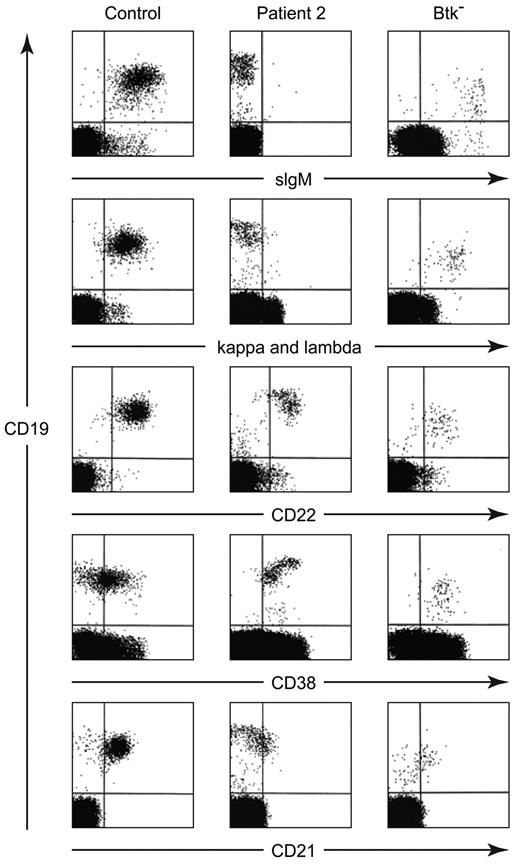 Figure 1. Flow cytometric analysis of peripheral blood lymphocytes from a healthy control, patient 2, and a patient with a mutation in Btk (8-bp deletion in exon 8). Cells were stained with PE-labeled anti-CD19 and separate aliquots were stained with FITC-labeled polyclonal anti-IgM, a combination of anti-κ and anti-lambda, monoclonal anti-CD22, CD38, or CD21. For the control samples, approximately 20 000 events were analyzed; for the patient samples, between 100 000 and 500 000 events were analyzed.