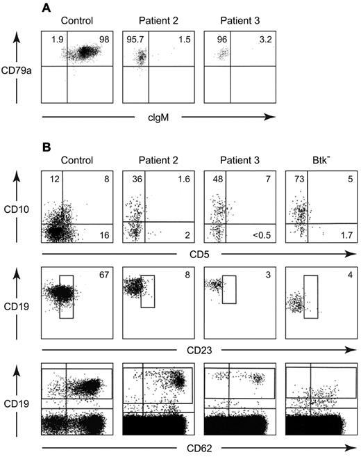 Figure 2. Further characterization of peripheral blood B cells from patients 2 and 3. Cells from a healthy control and the patients were permeabilized and stained with PerCP Cy5.5 anti-CD20, PE anti-CD79a, and FITC anti-IgM (A). The CD20+ cells were analyzed for expression of cytoplasmic CD79a and IgM. All of the cells were positive for CD79a, the percentage of cells positive or negative for cytoplasmic IgM is shown. Maturation and activation markers on peripheral blood B cells from a healthy control, patient 2, patient 3, and a patient with a mutation in Btk (G to C at the 1+ position of the splice donor site for intron 2) were stained with APC anti-CD19, PerCp Cy5.5 anti-CD20, PE anti-CD10, and FITC anti-20 (B). Cells that were positive for CD19 and CD20 were analyzed for expression of CD10 and CD5 (top). The percentages of B cells positive for each marker are shown. The middle and bottom panels show cells stained with PE anti-CD19, FITC anti-CD23, and APC anti-CD62L. The percentages of CD19+ cells that were dimly positive for CD23 are indicated. The pattern of CD62L staining is seen in the bottom panel.