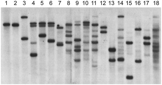 Figure 3. Heavy-chain gene rearrangements in EBV-transformed cell lines analyzed by Southern blot. DNA from EBV lines was digested with EcoRI and HindIII and probed with a J6 fragment. The DNA in lane 1 is from a T-cell line; the line from patient 1 is shown in lane 2. Lanes 3-6 contain DNA from lines from patient 2. The DNA in lane 7 is from the EBV line from patient 3. The DNA from the 4 polyclonal lines from patient 4 is shown in lanes 8-11. The DNA in lanes 12-14 is from lines from patients with XLA. The DNA in lanes 15-18 is from lines from healthy controls.