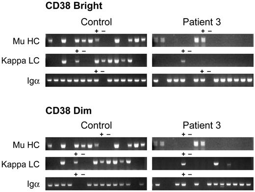 Figure 4. Immunoglobulin heavy- and light-chain gene rearrangements examined by single-cell PCR. CD19 bright/CD38 bright (A) and CD19 dimmer/CD38 dimmer (B) B cells from a healthy control and patient 3 were analyzed by single-cell RT-PCR. Each lane contains the PCR product from a single cell. Lanes containing positive (+) and negative (−) controls are marked. Igα (CD79a) was amplified from wells to document that the wells from patient 3 contained B cells.