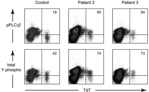 Figure 6. Analysis of the phosphorylation status of early B-lineage cells from a healthy control, patient 2, and patient 3. BM cells were permeabilized and stained with FITC-labeled anti-TdT and PE-labeled phospho-PLCγ2 or total tyrosine phosphorylation. The data are shown as density plots. Quadrants were drawn based on the positive and negative TdT− cells from the control. The percentage of TdT+ cells that was positive for the phospho-antibody is shown in the upper right corner of each plot.