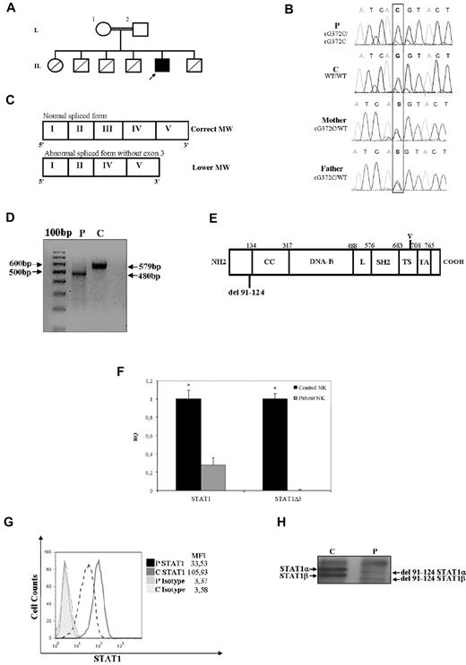 Figure 1. Novel STAT1 mutation associated with abnormal mRNA splicing and protein expression. (A) Family pedigree. Subjects I.1 and I.2 are first cousins. The proband is indicated with an arrow. Healthy persons are shown in white; deceased siblings are indicated by line crossing. (B) Genomic sequence analysis of exon 3 showing a homozygous nucleotide substitution at position 372 (G > C) affecting the donor splicing site. Both parents are heterozygous for the same mutation. (C) Schematic diagram of the first 5 exons of the STAT1 mRNA patient. Coding exons are indicated with Roman numerals and delineated by vertical bars. The upper band corresponds to the wild-type form. The lower band was observed for the cells of the patient and corresponds to the form of STAT1 mRNA lacking exon 3. (D) RT-PCR of STAT1 fragment spanning from exon 1 to exon 5 shows a lower size fragment in the patient. (E) Schematic representation of STAT1 protein structure, including the position of the 33 amino acid residue deletion (Δ91-124) in the N-terminal domain as a result of the G372C mutation affecting the donor splicing site of exon 3. Other domains included the coiled-coil (CC), DNA-binding (DNA-B), linker (L), Src-homology 2 (SH2), tail segment (TS), and transactivation (TA) domains. The position of Tyr701 (Y) is shown. (F) Expression of STAT1 and STAT1Δ3 mRNAs in NK cells from control and patient. Target gene expression was normalized against the housekeeping gene (GAPDH) and presented as n-fold increase over the expression in the healthy control. The experiments shown are representative of 4 independent experiments. Data are mean ± SE. *Significant difference in the response between the patient and control subject (P < .05). (G) Flow cytometry analysis of STAT1 expression in T cells (CD3+ cells), as measured by intracellular staining with anti-STAT1 mAb, was performed as described in “Cytokine, ELISA assay, and flow cytometry.” Mean fluorescence intensity is indicated. The results are representative of 4 independent experiments. (H) Immunoprecipitation and Western blot analysis of STAT1α and STAT1β were performed using an antibody against STAT1 on PBMCs (30 μg of total lysates) from the patient and a control subject. Analysis shows that the 2 bands corresponding to STAT1α and STAT1β were less abundant and at a reduced molecular weight.