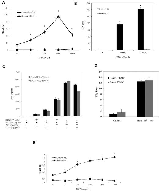 Figure 4. Impaired IFN-α and IL-27 response in a STAT1-deficient patient. (A-B) PBMCs and NK cells from the patient and a healthy subject were stimulated in vitro for 24 hours with increasing amounts of IFN-α (1, 5, 100, 1000, 5000, 10 000, and 100 000 U/mL). Target gene expression was normalized against the housekeeping gene (β-2-microglobulin and GAPDH for PBMC and NK cells, respectively) and presented as n-fold increase over the expression in unstimulated cells from the healthy control. The experiments shown are representative of 4 independent experiments. Data are mean ± SE. *Significant difference in the response between the patient and control subject (P < .05). (C) PHA-T (2 × 106/mL) were stimulated with IL-12 (200 ng/mL) or IFN-α (104 U/mL) in the presence or the absence of anti-CD3 mAb (5 μg/mL) or with a combination of anti-CD3 and anti-CD28 mAb (5 μg/mL) for 24 hours in RPMI 1640 supplemented with IL-2 (1200 U/mL). Supernatants were collected after stimulation, and IFN-γ levels were evaluated by ELISA. (D) PBMCs from the patient and a healthy subject stimulated in vitro for 24 hours with IFN-α (104 U/mL). Target gene expression was normalized to the housekeeping gene (β2M) expression and presented as n-fold of the expression in unstimulated cells from the healthy control. The experiments shown are representative of 4 independent experiments. Data are mean ± SE. *Significant difference in the response between the patient and control subject (P < .05). (E) NK cells from the patient and a healthy subject were cultured without IL-2 for 16 hours and then stimulated in vitro with the indicated doses of IL-27 for 24 hours. Target gene expression was normalized against the housekeeping gene (GAPDH) and presented as n-fold increase over the expression in unstimulated cells from the healthy control subject. The experiments shown are representative of 4 independent experiments. Data are mean ± SE. *Significant difference in the response between the patient and control subject (P < .05).