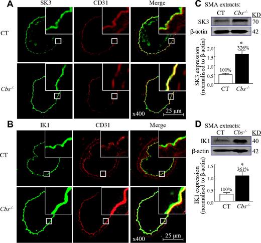 Figure 3. HHcy-stimulated SK and IK expression in SMAs of Tg-hCBS Cbs mice. Mouse SMAs cross-sections were immunostained with antibodies against SK3 (green, A) or IK1 (green, B), and costained with the endothelial marker CD31 (red). Merged image (yellow to orange) shows that SK3 and IK1 are localized in the endothelium and increased in Cbs−/− mice. (C-D) Immunoblot of SK3 and IK1 in SMA extracts and quantification. Values are means ± SEM (n = 5-7 mice). *P < .05 compared with control mice. CT indicates the control group.