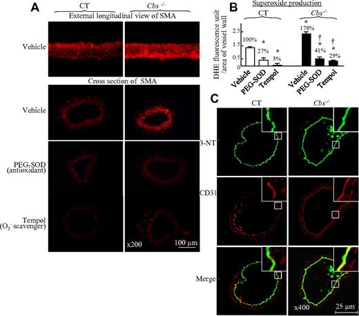 Figure 4. HHcy-induced oxidative stress in SMAs of Tg-hCBS Cbs mice. Mouse SMA segments and cross-sections were incubated with the antioxidants PEG-SOD (150 U/mL) or the O2− scavenger Tempol (1mM), and stained with the O2− marker DHE (red, A) or 3-NT (green, C), and costained with endothelial marker CD31 (red, C) antibodies. Merged image (yellow to orange, C) shows that 3-NT is localized to the endothelium and increased in Cbs−/− mice. (B) Quantitative analysis of O2− generation by DHE staining in panel A. Values are means ± SEM (n = 5-7 mice). *P < .05 compared with vehicle in control mice; †P < .05 compared with vehicle in Cbs−/− mice. CT indicates the control group.