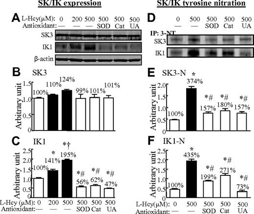Figure 7. L-Hcy–increased IK1 expression and oxidation/nitration of SKs and IKs in HCMECs. HCMECs were treated with or without L-Hcy at the indicated concentrations for 48 hours. Western blot analysis was performed for SK3 and IK1 in HCMECs extracts before (A) and after (D) immunoprecipitation with 3-NT antibody. Values are means ± SEM (n = 3). *P < .05 compared with no-treatment parallel control; †P < .05 compared with Hcy 200μM; and #P < .05 compared with Hcy 500μM. CT indicates the control group; UA, uric acid.