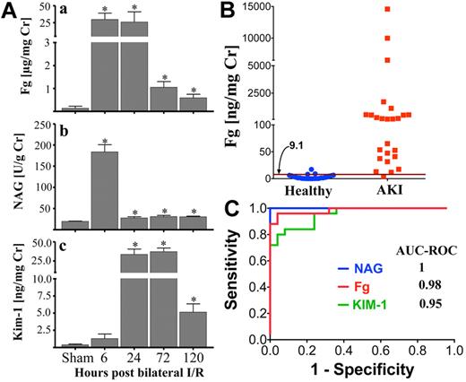 Figure 3. A significant increase in urinary Fg after kidney injury in rats and humans. (A) Urinary Fg was compared with tubular injury biomarkers NAG and Kim-1 in rats subjected to 20 minutes of bilateral renal I/R injury (n = 5/group). *P < .05 as determined by Student t test in comparison with sham rats. (B) Urinary Fg was measured in a human cross-sectional study with clinically established multifactorial AKI and/or CKD (n = 25) versus healthy volunteers (n = 25). Magenta line and corresponding number marked by arrow indicate a threshold cutoff value at 95% specificity. (C) ROC comparing the sensitivity and specificity of urinary Fg, NAG, and KIM-1 to distinguish patients with AKI and/or CKD from healthy volunteers.