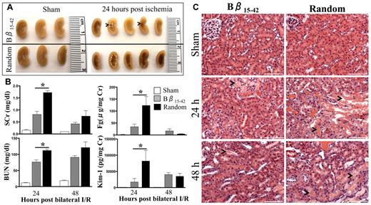 Figure 4. Bβ15-42 peptide protects mice from renal I/R injury. Male C57Bl/6 mice were subjected to 27 minutes of bilateral renal I/R injury or sham surgery and 3.6 mg/kg Bβ15-42 peptide or random peptide was administered intravenously 1 minute after reperfusion. (A) The medullary congestion after ischemia was significantly less in the Bβ15-42 peptide–administered mice compared with mice administered random peptide. Outline of vascular congestion traced by white dots. (B) SCr and BUN as indicators of renal dysfunction and urinary levels of Fg and Kim-1 as indicators of kidney injury were measured at 24 and 48 hours in all the groups (n = 5/group of sham, n = 10/group at 24 hours, and n = 5/ group at 48 hours). *P < .05 as determined by 1-way ANOVA in comparison with sham mice. (C) Representative H&E stained kidney sections comparing sham, Bβ15-42 and random peptide–administered groups of mice at 24 and 48 hours after ischemia. Bar represents 100 μm (20× magnification).