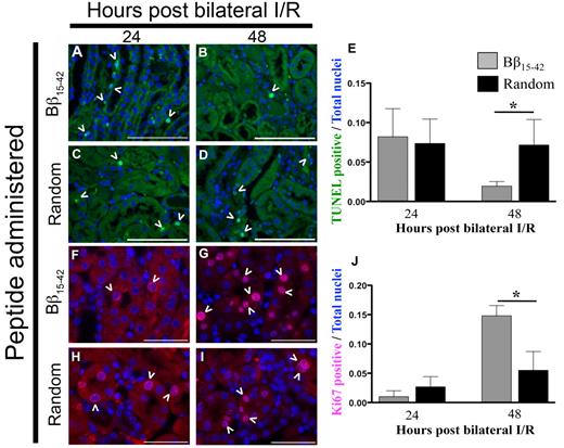 Figure 5. Bβ15-42 peptide aids in the resolution of injury by decreasing necrosis/apoptosis and inducing rapid tissue regeneration. Paraffin-embedded kidneys of mice subjected to 27 minutes of bilateral I/R that were administered either Bβ15-42 or random peptides were compared at 24 and 48 hours for number of apoptotic cells (green; A) by TUNEL assay (bar represents 100 μm, 40× magnification). Arrowheads indicate TUNEL-positive nuclei. (B) Number of proliferative cells determined by Ki67-positive staining cells (red; bar represents 50 μm, 60× magnification). The numbers of positive staining TUNEL and Ki67 nuclei are represented graphically on the right of respective photomicrographs. Arrowheads indicate Ki67 positively stained nuclei. *P < .05 as determined by Student t test between the 2 groups within the same time point.