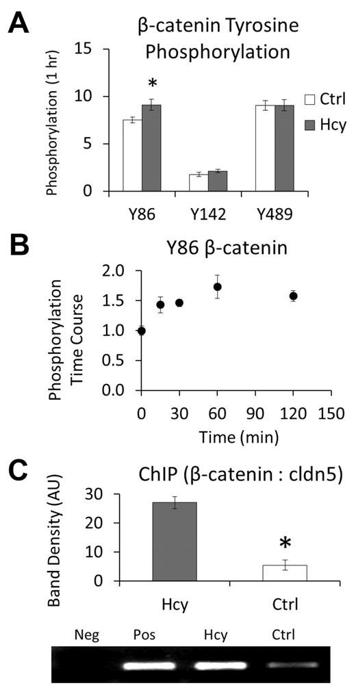 Figure 2. Hcy leads to phosphorylation, nuclear localization, and binding of β-catenin to the claudin-5 promoter. (A-B) Data were obtained by performing whole-cell ELISAs using the respective site-specific antiphosphotyrosine antibodies. (A) Initial screening of modification sites on β-catenin after 1-hour treatment with Hcy (100μM). (B) Time course for phosphorylation of β-catenin at Y86, a modification that has been associated with nuclear accumulation, in response to Hcy (20μM). (C) Chromatin immunoprecipitation assay performed by immunoprecipitation of β-catenin and PCR for the repression segment of the claudin-5 promoter region. Assay was run after 3 days of treatment with: Hcy (20μM), Ctrl (vehicle, PBS), Pos (positive control, whole cell lysate DNA), or Neg (negative control, primers only, no DNA).