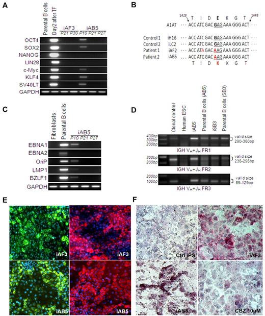 Figure 2. Characterization of the EBV-B cell line–derived iPSCs. (A) Reprogramming genes were not detected in PCR analysis of genomic DNA, indicating generation of integration-free iPSCs. Day 2 transfected cells were included as a positive control, and parental cells were used as a negative control. (B) AAT sequence of human iPSC lines generated from patient fibroblasts and EBV-B cell lines. The inherited Z mutation was preserved after reprogramming of both cell types. Human iPSC lines derived from either healthy volunteers (iH16) or other disease (iLC2, liver cirrhosis), which do not carry the Z mutation, were used as controls. (C) EBV-related genes (EBNA-1, EBNA-2, OriP, LMP-1, and BZLF-1) were analyzed by PCR analysis of genomic DNA obtained from human fibroblasts, parental B cells, and the B-cell line–derived iPSCs. PCR results reveal the absence of EBV DNA in B-cell line–derived iPSCs after passage 20. (D) Three sets of PCR primers were used to detect IGH rearrangements occurring in committed B cells. A clonal control was included as a positive control, and human ESC (H9) was used as a negative control. Both the parental EBV-B cell lines and the cell line–derived iPSC lines showed positive signals of IGH rearrangement. (E-F) Disease modeling potentials. On the basis of our hepatic differentiation protocol, all these patient iPSCs were able to directly differentiate into mature hepatocyte-like cells expressing albumin (green, left) and AAT (red, right); representative images are shown with iAF3 and iAB5 (E). Numerous PASD-positive inclusion bodies (one of the most important AAT deficiency–related liver pathologic features, pink) were detected within mature hepatocytes derived from the AAT patient iPSCs (iAF3, iAB5) but not in the control iPSC (iLC2)-derived hepatocytes (F). The level of PASD-positive inclusion body was decreased with carbamazepine treatment (iAF3, 10μM for 5 days, bottom right).