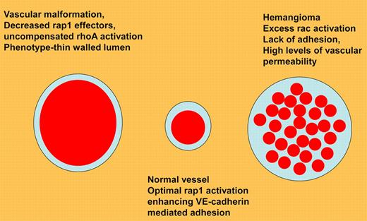 Mulliken and Folkman's classification of vascular anomalies defined by G protein abnormalities.9 Vascular malformation results from lack of rap1 effectors, leading to constitutive rhoA/ROCK activation. Normal vessels have high levels of rap1/integrin/VE-cadherin activation, leading to lack of vascular permeability. Hemangiomas demonstrate constitutive rac activation, and thus can be treated by agents that inhibit rac/reactive oxygen signaling.