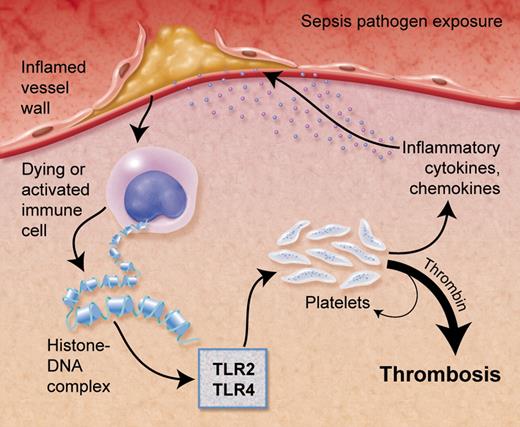 In the setting of sepsis or localized inflammation, such as with a ruptured atherosclerotic plaque, histone-DNA complexes are released from cells leading to platelet activation and thrombin generation via toll-like receptors (TLR2/TLR4). Professional illustration by Alice Y. Chen.