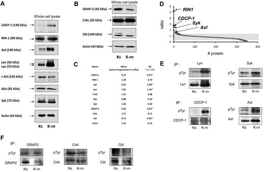Figure 1. Validation of SILAC results by Western-blotting. Proteins identified by SILAC were detected in nilotinib-sensitive Ks or nilotinib-resistant K-rn cell lysates. After transfer, specific proteins were individually detected for proteins over detected in K-rn (A) or down detected (B). After stripping, membranes were probed for actin as loading control. Proteins detected are indicated by an arrow on the left. Quantification of protein expression was performed by densitometry (C). Protein expression level was normalized using actin as loading control. Results are expressed as the mean fold increase expression for each protein by calculating the ratio of the K-rn cells to their sensitive counterpart Ks from at least 3 independent experiments. Significance was calculated by Mann Whitney test and indicated by an asterisk. Proteins identified by mass spectrometry and scored by SILAC were graphically represented as the ratio between the heavy and light isotope (D). Indicated proteins were immunoprecipitated from Ks or K-rn cell lysates. Tyrosine phosphorylated proteins were detected followed by the specific detection of immunoprecipitated proteins over detected in K-rn (E) or down detected (F). Results shown are from one independent experiment representative of 3.