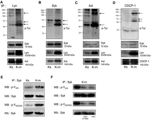 Figure 2. Detection of tyrosine phosphorylated proteins associated with the kinases Lyn, Syk and Axl. Proteins (A: Lyn; B: Syk and C: Axl, D: CDCP-1) were immunoprecipitated from Ks and K-rn cell lysates and subjected to phosphotyrosine Western blotting using a mix of 4G10 and pY-100 antibodies (top panels). Differentially tyrosine phosphorylated proteins are indicated by arrows on the right. After stripping, membranes were cut and blotted against Syk (top), Lyn (middle), Axl (bottom panels). Results are from one experiment representative of 5. (E) Syk was immunoprecipitated from Ks and K-rn cell lysates. Immunprecipitates were subjected to Western-blotting using phosphospecific antibodies against residues Y323 and Y525/526, and reprobed for whole Syk. (F) Syk was immunoprecipitated from K-rn cell lysates from untreated, BAY 61-3606–treated (2μM 2 hours) and PP2-treated (20μM 2 hours) K-rn cells. Immunoprecipitates were subjected to Western blotting using phosphospecific antibodies as described in panel E.