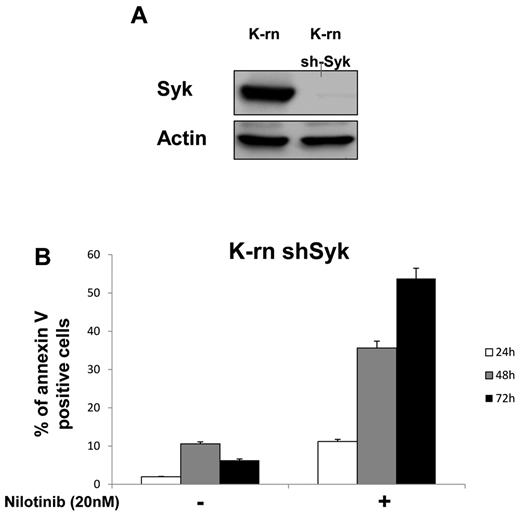 Figure 4. Silencing Syk restores nilotinib sensitivity. K-rn cells were infected by lentivirus coding for a shRNA anti-Syk, grown for 10 days, selected for DsRed expression and purified by cell sorting. Syk silencing was confirmed by Western blotting (A) and apoptosis in response to nilotinib was measured on both K-rn and K-rn ShRNA Syk cells by cytometry using annexin V-FITC (B). Results are expressed as the percentage of annexin V positive cells.