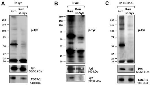 Figure 6. Inhibition of Syk expression altered phosphorylation and interaction of Lyn, Axl and CDCP-1. Lyn (A), Axl (B) and CDCP-1 (C) were immunoprecipitated from K-rn and K-rn sh-Syk cells. After transfer, membranes were probed for tyrosine phosphorylated proteins using a mix of 4G10 and pY-100 antibodies (top panels). After stripping, membranes were cut and reprobed as indicated. Results are from 1 experiment representative of at least 3.