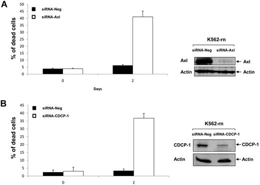 Figure 7. siRNA targeting Axl or CDCP-1 decrease nilotinib resistance. K-rn cells were transfected with 200nM of siRNA corresponding to a negative control siRNA (siRNA Neg) or targeted siRNA; siRNA Axl (A) or siRNA-CDCP-1 (B). Cells were seeded at 2 × 105/mL in RF-10 for 24 hours after incubated in the presence of 20nM nilotinib. Aliquots of the culture were harvested at day 2 for measurement of cell death by triplicate trypan blue exclusion counts and protein expression analysis. Results are from one experiment representative of 2.