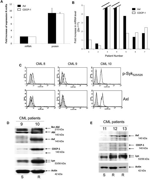 Figure 8. Axl and CDCP1 are over expressed in nilotinib resistant CML cells. (A) Total mRNA (1 μg) from Ks and K-rn cells were reverse transcribed into cDNA and used in Q-PCR to quantify the mRNA expression of Axl (black box) and CDCP-1 (white box) between Ks and K-rn cells. In parallel, the level of protein expression was quantified by densitometry analysis of 5 separate Western-blots. Results are expressed as a fold increase expression for the mRNA by the ΔΔ Ct method and the protein by the ratio of K-rn/Ks. (B) Seven CML patients (2 males, 5 females) were investigated as previously described.8 All patients were analyzed at the beginning or before nilotinib treatment and under treatment at the moment of nilotinib failure in chronic phase (number 6 and 7) or in accelerated phase (number 1 to 5). Quantitative Real-time PCR to amplify Axl (black box) and CDCP-1 (white box) transcripts was carried out on the cDNA. Analysis was done by comparison of the 2 time points (before nilotinib and under treatment at the moment of failure) by the comparative ΔΔCt method giving the fold increase of the amount of target normalized to the endogenous reference as 2- ΔΔCt. (C) Purified CD34 positive cells from blood samples of CML patients (8 and 9 responding to nilotinib, 10 resistant to nilotinib) were analyzed by flow cytometry as described in “Methods” for Syk phosphorylation (phosphospecific antibody p-Syk 525/526) and Axl expression. Control using non immune IgG (gray histogram) and specific antibody (white histogram) are shown. (D) Bcr-Abl, Axl, CDCP-1 and Lyn were detected by Western-blotting using protein samples from CML 9 and 10 patients. (E) CD34 positive cells from nilotinib-responding (11: S) or resistant (12 and 13: R) CML patients were isolated and solubilized in Laemli buffer. Proteins were separated by SDS-PAGE and specific proteins were detected by Western-blotting as indicated. Actin was used as a loading control.