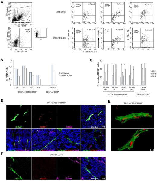 Figure 4. Adult human CD34−Lin−CD45−CD133− cells give rise to both hematopoietic and endothelial lineage cells in NOD/SCID mice. (A) Example of multilineage human hematopoietic (CD45+) reconstitution of BM cells from the IBMI of NOD/SCID recipients receiving CD34−Lin−CD45−CD133− cells that include CD34 (stem/progenitor hematopoietic cells), CD33 (myeloid), and CD19 (B lymphoid) lineage markers. Representative results from 4 injected mice. (B) Frequency of cells positive for human CD45 staining in the BM of mice that received a transplant. Graph showing the results obtained in each experiment; m indicates mouse. (C) Coexpression of human CD34, CD33, and CD19 by CD45+ in BM cells from the same mice. Graph showing the results obtained in each experiment; m indicates mouse; LB, left bone; and OB, other bones. (D) Mouse CD31, human CD31, and human CD45 immunostaining of MOPC315 tumor tissues from mice injected 4 weeks earlier with 2 × 102 CD34−Lin−CD45−CD133− cells. (Top) Confocal microscopy images (3-dimensional rendering) showing the colocalization of mouse tumor vessels (mouse CD31+) and human CD31+ cells, which fail to costain for human CD45. (Bottom) Confocal microscopy images showing human CD31+/CD45− and human CD45+/CD31− cells proximal or distant from mouse CD31+ vessels. The asterisk points to a human CD45+ cell (pink) adjacent to a human CD31+ cell (red); the cells are shown at a higher magnification in the inset. The arrowheads point to the colocalization (yellow) of mouse CD31 (green) and human CD31 (red) immunostaining. The arrow in the far right panel points to a human CD45+/CD31− cell. Scale bars = 50 μm. (E) Images from clipping and rotation of a 3-dimensional confocal image of a tumor vessel from a mouse injected 4 weeks earlier with CD34−Lin−CD45−CD133− cells showing the spatial relationship between the murine endothelial cells (green, mCD31+) and the human endothelial cells (red, hCD31+) contributing to the vessel wall. Scale bar = 50 μm. (F) MOPC315 tumor tissue from a mouse injected with 1 × 103 CD34−Lin−CD45+ cells shows vascular structures expressing mouse but not human CD31. Clusters of human CD45+ cells are observed. Results from immunostaining with specific anti–mouse CD31 (green), anti–human CD31 (red), and anti–human CD45 (pink) are shown. Nuclei are detected by DAPI staining (blue). FSC indicates forward scatter.