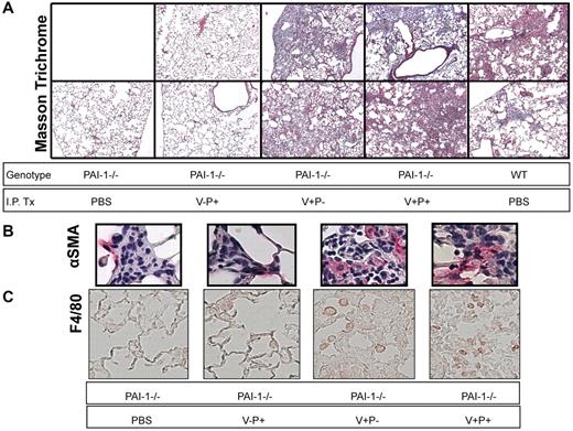 Figure 5. Lung histology after bleomycin injury. PAI-1−/− and WT mice were treated with intratracheal bleomycin (1.15 μg/kg in 50 μL of sterile PBS) on day 0. Subgroups of PAI-1−/− mice were administered PAI-1(V+P+), PAI-1(V+P-), and PAI-1(V-P+) at 100 μg/injection every 12 hours beginning on day 8 and continuing through day 19. For comparison, groups of bleomycin-injured PAI-1−/− mice and WT mice received twice-daily intraperitoneal injections of PBS. On day 19, the left lung was fixed, and 5 micron sections were stained using Masson's trichrome (A) or immunostained with antibodies to α-SMA (B) and F4/80 (C). Images of representative sections from 2 mice (Masson trichrome) or a single mouse (immunostaining) in each treatment group are shown. Micrographs for panels A and B were obtained with a Nikon Eclipse E400 microscope (Melville, NY) and a Nikon 10×/0.25 lens (A) and a Nikon 40×/0.65 lens (B) and captured with a Diagnostic Instruments camera and SPOT Basic Version 4.0.8 acquisition software. Micrographs for panel C were obtained with a Nikon Eclipse 80i microscope and a Nikon 20× lens and captured with a Nikon DS-Qi1Mc camera and Nikon NIS-Elements BR 3.10 software.