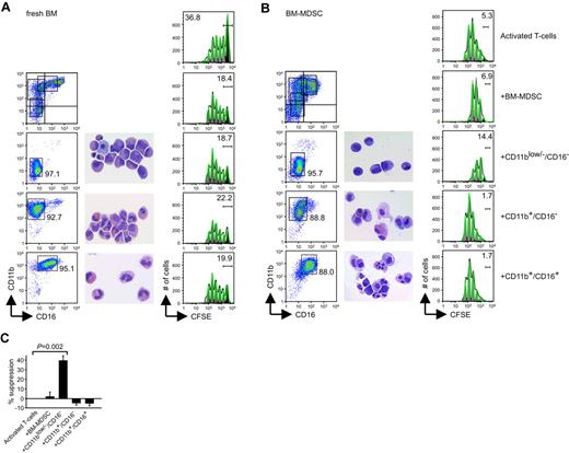 Figure 3. CD11blow/−/CD16− phenotype defines the subset responsible for the immune suppression in BM-MDSCs. (A) Flow cytometric evaluation of CD11b and CD16 markers in BM-MDSC or sorted CD11blow/−/CD16−, CD11b+/CD16− and CD11b+/CD16+ cell populations from fresh BM samples (left), structural analysis by May-Grünwald-Giemsa staining (center), and CFSE dilution proliferation assay (right) in which values reported on histograms represent the percentages of cells in the parental, undivided generation. (B) Flow cytometric evaluation of CD11b and CD16 markers in BM-MDSCs or sorted CD11blow/−/CD16−, CD11b+/CD16−, and CD11b+/CD16+ cell populations from BM-MDSCs (left), structural analysis by May-Grünwald-Giemsa staining (center), and CFSE dilution proliferation assay (right) in which values reported on histograms represent the percentages of cells in the parental, undivided generation. (C) Suppression of allogenic CFSE+ PBMCs activated with anti-CD3 and anti-CD28 and cocultured in the presence of 1:1 ratio of the different populations sorted from human BM-MDSCs. The suppression was calculated, analyzing the number of proliferating cells from generation 3 to generation 10, assumed to be 100% without BM-MDSCs. Mean ± SE of 3 independent experiments. P ≤ .01, Student t test, all comparisons among BM-MDSCs containing cultures versus cultures without BM-MDSCs.