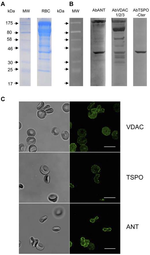 Figure 2. VDAC, ANT and TSPO detection in human red blood cell ghosts. Samples (15 μg of protein) of whole lysates were subjected to SDS-PAGE (10% acrylamide) and stained with Coomassie blue (A) or analyzed by Western blotting using polyclonal anti-ANT (1:1000 dilution), rabbit polyclonal anti VDAC1 -2, -3 (1:100 dilution) or polyclonal goat anti-TSPO raised against the C terminus of human TSPO (1:1000). The positions of molecular weight (kDa) protein standards are indicated by arrows. (B) 4 bands appearing between 29-30 kDa and 36 kDa correspond to different isoforms of VDAC and marked band at 58 kDa correspond to dimers of VDAC1 isoform (29-30 kDa). Multiple bands at higher molecular weights suggest oligomerization of VDAC proteins. ANT and TSPO proteins are also clearly visible. It is to be noted that, according to the supplier assessment (Everest Biotech), the TSPO protein could not be expected at 18 kDa but rather at 36 kDa. These blots are representative of 12 replicates. Immunofluorescence experiments (C) were performed on smears prepared as described in “Immunostaining.” Dilution were 1/5 for primary and 1/20 for secondary antibodies. Scale bars represent 10μm.