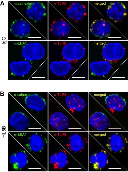 Figure 6. aPLs induce translocation of TLR8. Confocal images of MonoMac1 cells stained with anti-TLR8 (red) and anti-calnexin or anti-EEA1 (green). Nuclei were visualized with DAPI (blue). Before fixation cells were either stimulated with IgG or HL5B (100 ng/mL) for 30 minutes. In cells incubated with IgG (A) TLR8 colocalized with calnexin but not with EEA1. In addition, some TLR8 did not colocalize with either marker. In cells incubated with HL5B (B) colocalization of TLR8 with calnexin was not detectable, whereas there was significant overlap with EEA1. Again, some TLR8 did not colocalize with either marker. To allow better appreciation of the cellular features, a montage of representative cells from the same experiment on the same slide was prepared.