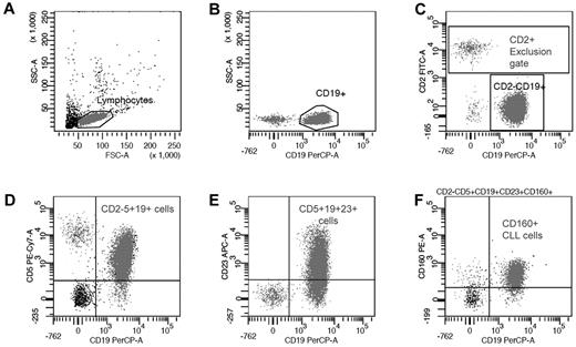 Figure 1. Sequential gating strategy for CD160 detection on malignant CD19+ B cells. (A) Total B cells were identified using forward and side scatter to gate the lymphoid region and exclude any apoptotic cells and debris. (B) CD19+ B cells were compared with side scatter to exclude any nonspecific binding. (C) CD19+ B cells were further isolated by gating the CD2+ events and generating a “NOT” (exclusion) gate. (D) The malignant B cells were separated from the normal residual B cells using a CD2−CD5+CD19+ gate. (E) CD23 expression was calculated from the malignant population and used to generate the mini-CLL score and CD23r. (F) In the context of CLL, CD160 positivity defined on the CD2−CD5+CD19+CD23+ population was then calculated from this “pure” malignant B-cell population.