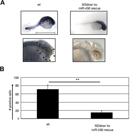 Figure 5. Macrophage development is dependent on microRNA expression. (A) MZdicer KO embryos were rescued in development by injection of mature miR-430 RNA.26 Comparison of L-plastin+ macrophages between WT and rescued MZdicer KO (MZdicer+430) zebrafish embryos 24-30 hpf. Macrophage development can be detected in early stages in the yolk sac and after that in the mesenchyme of the head and the blood circulation. Each embryo is shown as an overview (scale bar indicates 1 mm) and as a lateral magnified view of the head (scale bar indicates 100 μm). Nine embryos were analyzed in each experiment. (B) Quantification of L-plastin+ macrophage numbers in z-stack image files of whole-mount in situ hybridizations from controls or MZdicer+430 zebrafish as shown in panel A. **P < .001 by Student t test. Error bars indicate SD.